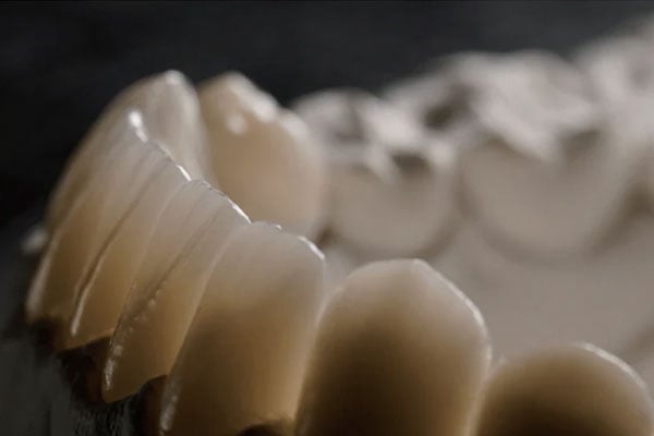 High-quality zirconia dental restoration from the Best Dental Lab, offering strength, durability, and aesthetics
